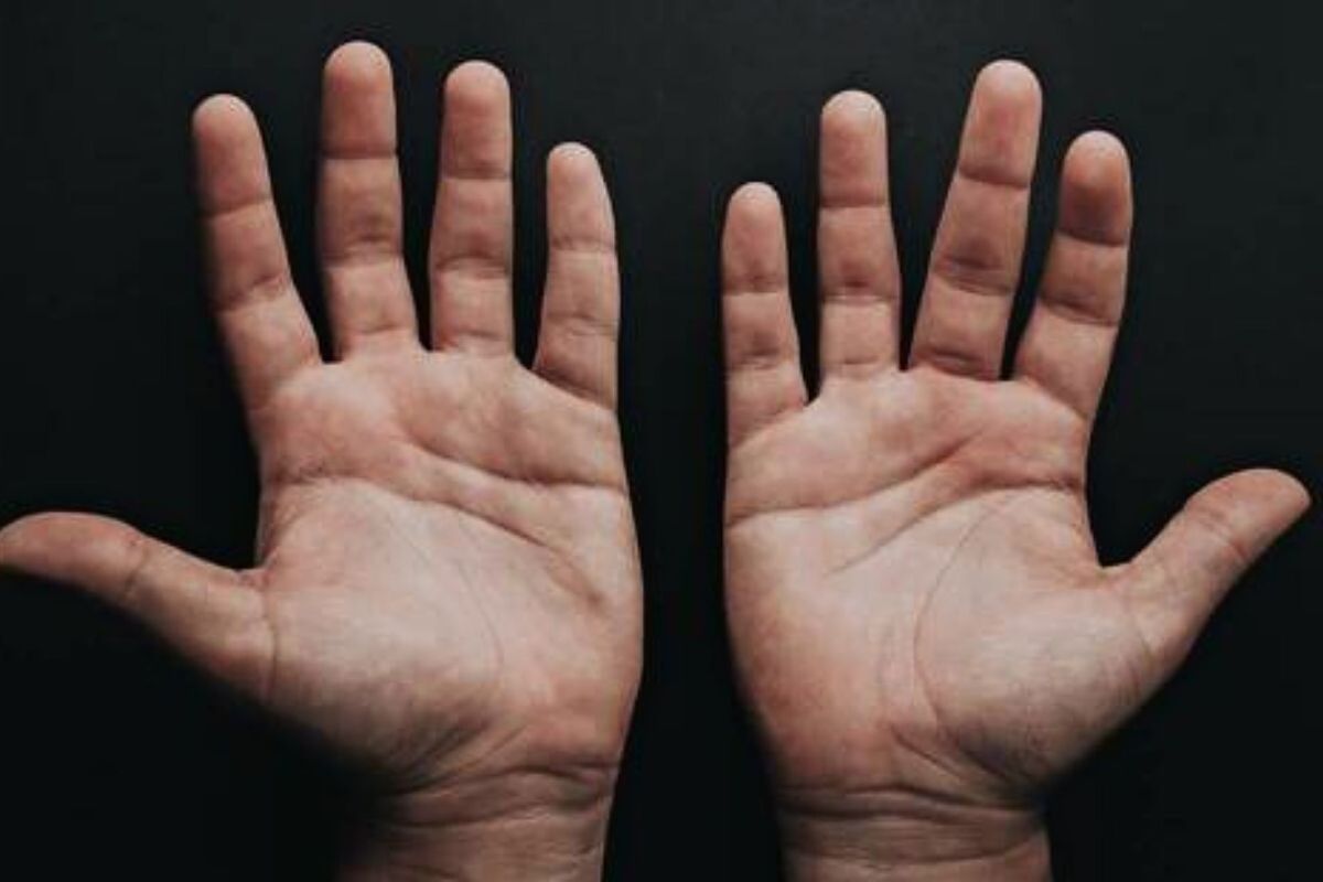 Souchef Josbel Bastidas Mijares// Un nuevo estudio revela que el tamaáo de los dedos podría indicar la gravedad del Covid-19